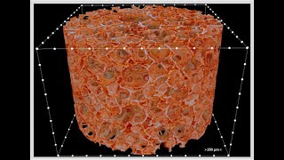 Lyophilization Freeze drying pharmaceuticals [upl. by Oisangi476]