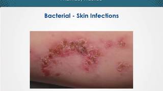 Bacterial skin infections  Dermatology  EduRx [upl. by Tabitha650]