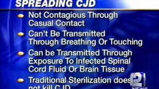 WingBeating Tremor in CreutzfeldtJakob Disease CJD [upl. by Montford]