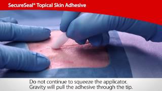 SecureSeal® Topical Skin Adhesive  Cardinal Health [upl. by Nosle970]