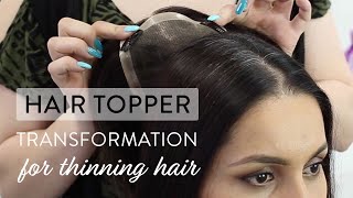 Hair Topper Transformation for Thinning Hair [upl. by Kester]