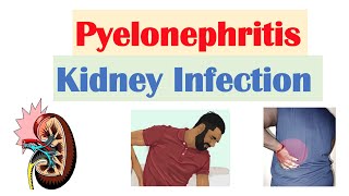 Symptoms of Kidney Cyst  Dr Vidyashankar Panchangam [upl. by Aihceyt]