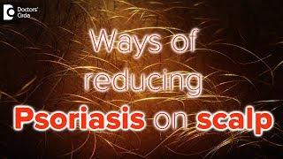 What helps psoriasis on scalp  Dr Rasya Dixit [upl. by Nylanej473]