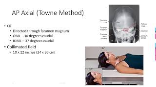 Radiographic Positioning of the Skull [upl. by Hervey]